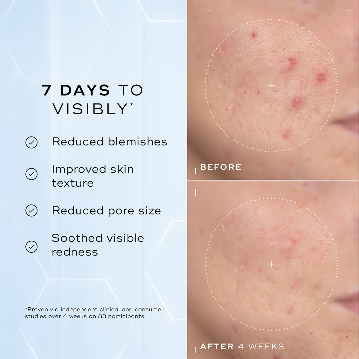 Niacinamide Peptides