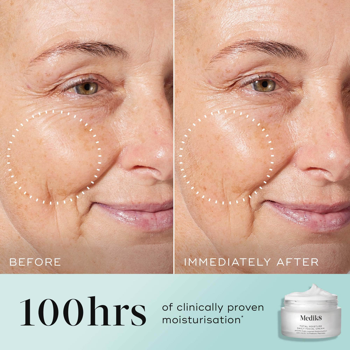 Total Moisture Daily Facial Cream Refill™