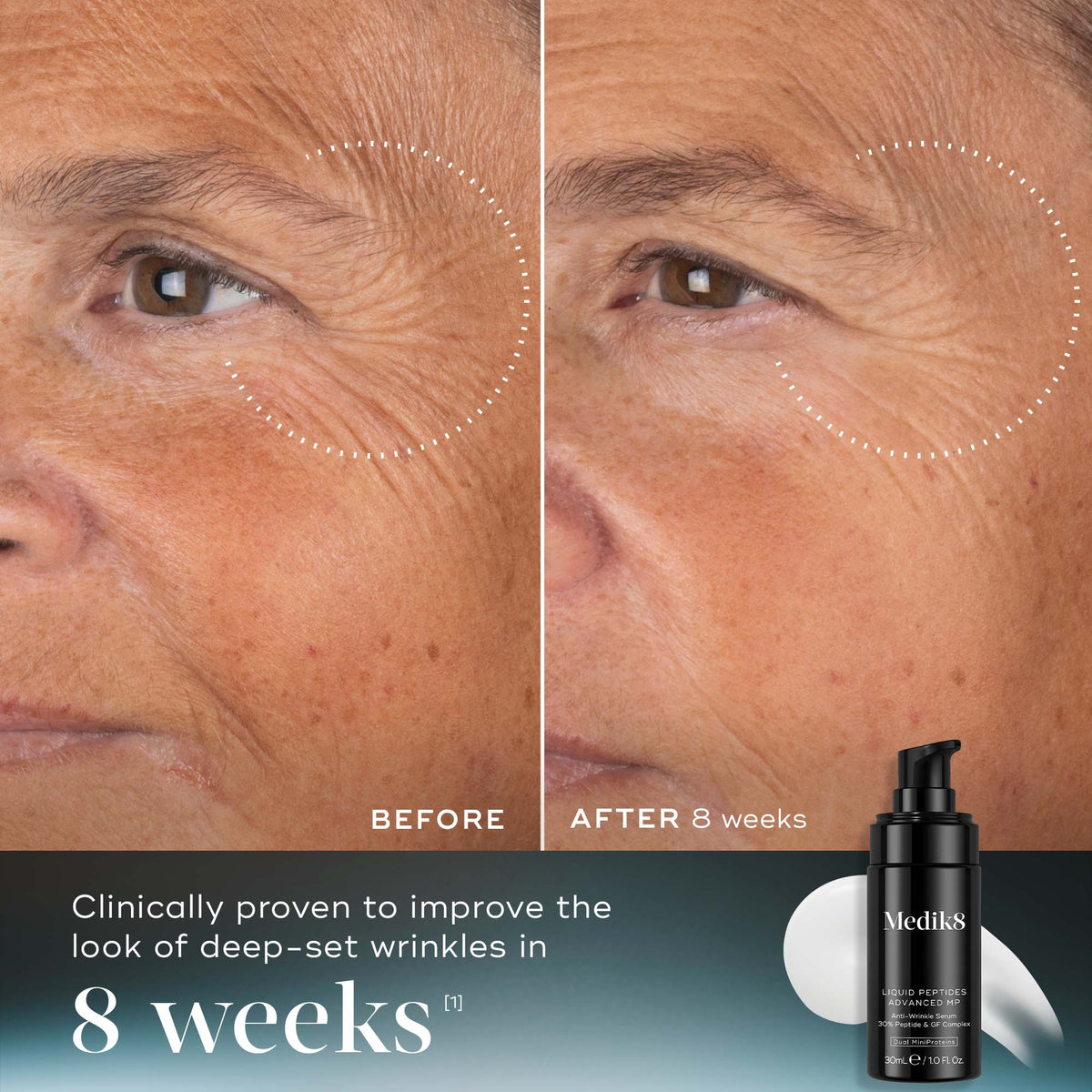 Liquid Peptides Advanced MP & Exo-PDRN Prismatic+ Bundle