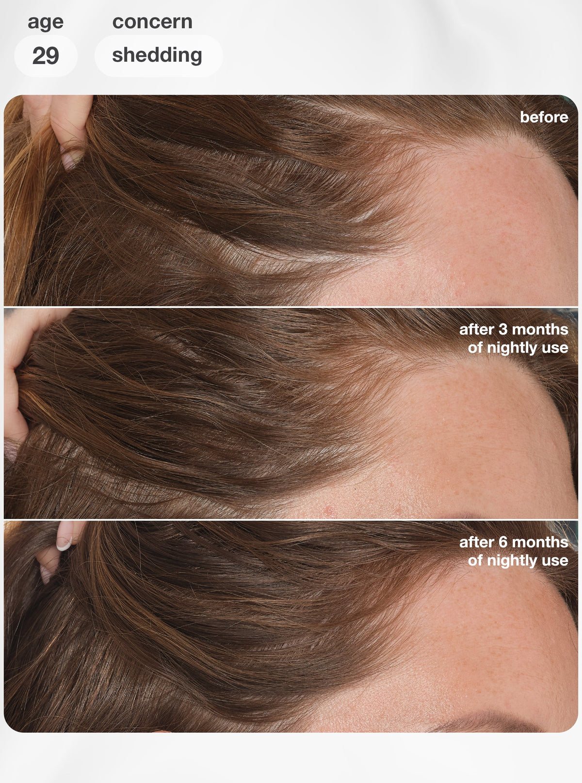 FutureIQ™ biomimetic hair longevity serum